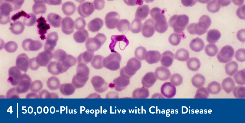 4 - 50,000-Plus People Live with Chagas Disease An image of the parasite responsible for Chagas Disease