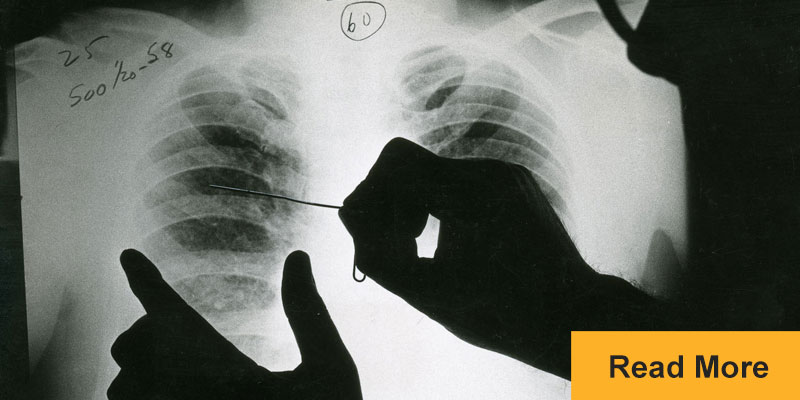 doctor examines x-ray of lungs