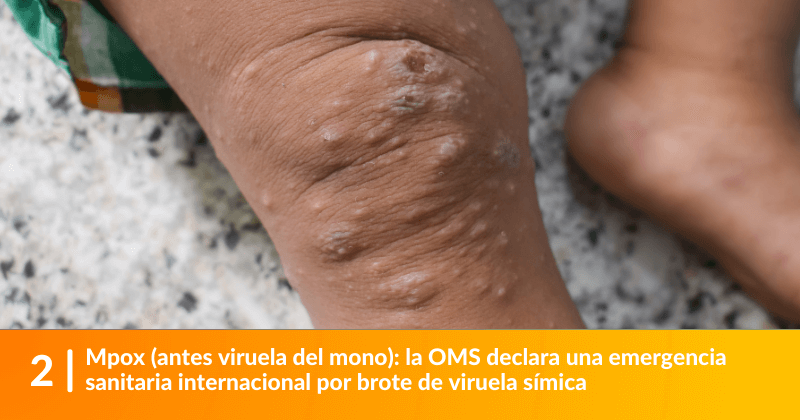 Mpox (antes viruela del mono): la OMS declara una emergencia sanitaria internacional por brote de viruela símica.