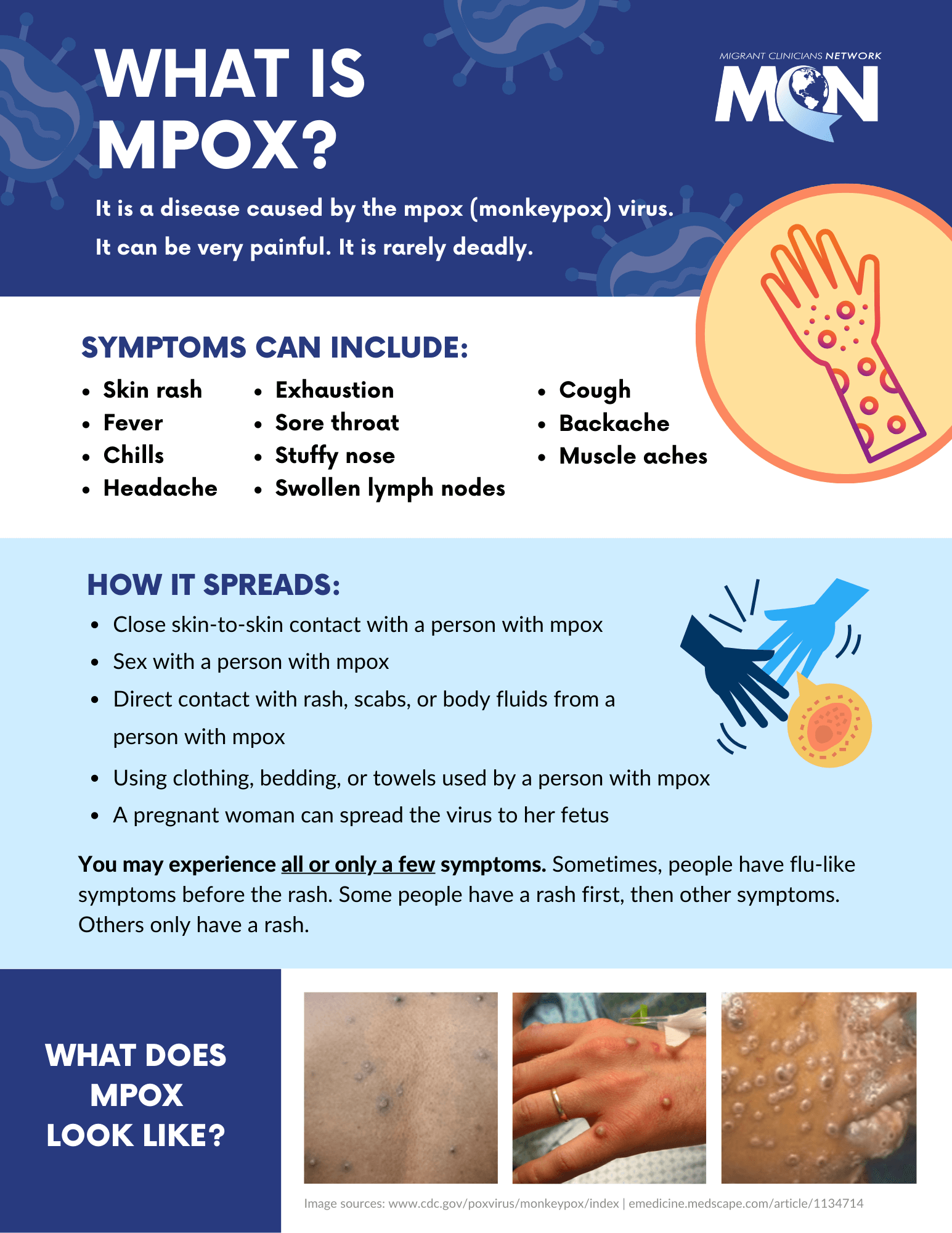 What is Mpox