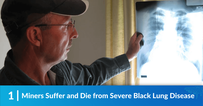 Miners Suffer and Die from Severe Black Lung Disease